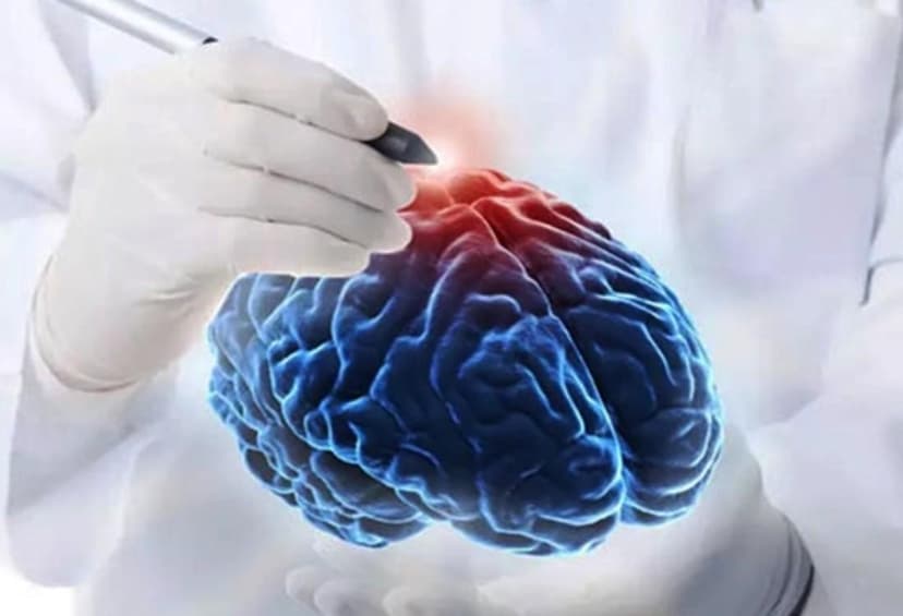 NEUROSURGERY