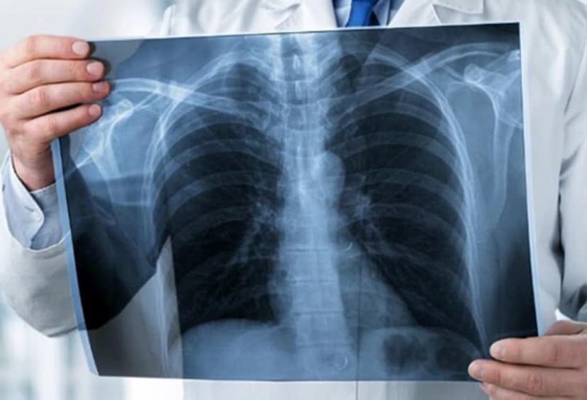 RADIOLOGY