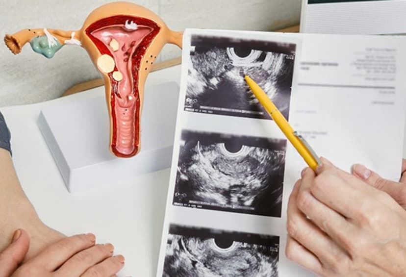 GYNAECOLOGY